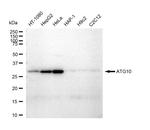 ATG10 Recombinant Rabbit Monoclonal Antibody (23GB4860)