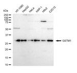GSTM1 Recombinant Rabbit Monoclonal Antibody (23GB4940)