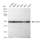 ATP5A1 Recombinant Rabbit Monoclonal Antibody (23GB4850)