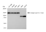 COL11A1 Recombinant Rabbit Monoclonal Antibody (23GB5100)