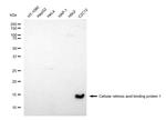 CRABP1 Recombinant Rabbit Monoclonal Antibody (23GB5105)