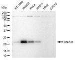 RCL Recombinant Rabbit Monoclonal Antibody (23GB5180)