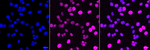 DOK1 Antibody in Immunocytochemistry (ICC/IF)