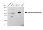 DPYD Recombinant Rabbit Monoclonal Antibody (23GB5195)