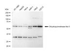 CRMP5 Recombinant Rabbit Monoclonal Antibody (23GB5200)