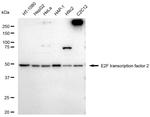 E2F2 Recombinant Rabbit Monoclonal Antibody (23GB5250)