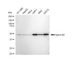 Ephrin B2 Recombinant Rabbit Monoclonal Antibody (23GB5270)