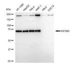 eIF2b epsilon Antibody in Western Blot (WB)