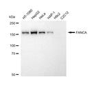 FANCA Antibody in Western Blot (WB)