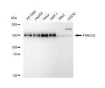 FANCD2 Recombinant Rabbit Monoclonal Antibody (23GB5365)