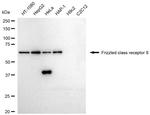 FZD8 Recombinant Rabbit Monoclonal Antibody (23GB5470)