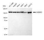 GABBR1 Recombinant Rabbit Monoclonal Antibody (23GB5495)