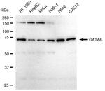 GATA6 Recombinant Rabbit Monoclonal Antibody (23GB5525)