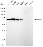 GNE Recombinant Rabbit Monoclonal Antibody (23GB5560)