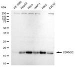 CDKN2C Recombinant Rabbit Monoclonal Antibody (23GB5650)