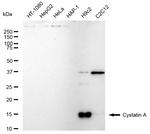 Cystatin A Recombinant Rabbit Monoclonal Antibody (23GB5665)