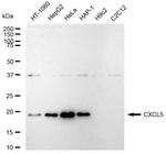CXCL5 Recombinant Rabbit Monoclonal Antibody (23GB5670)
