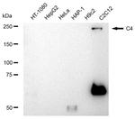 Complement C4 Antibody in Western Blot (WB)