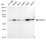 PMP70 Recombinant Rabbit Monoclonal Antibody (23GB5010)