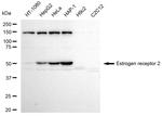 Estrogen Receptor beta Recombinant Rabbit Monoclonal Antibody (23GB5755)