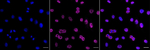 GBA Recombinant Rabbit Monoclonal Antibody (23GB5775)