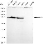 FRS2 Recombinant Rabbit Monoclonal Antibody (23GB5785)