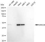 ERCC8 Antibody in Western Blot (WB)