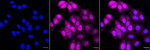 LGI1 Recombinant Rabbit Monoclonal Antibody (23GB5930)