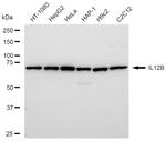 IL-12 p40 Recombinant Rabbit Monoclonal Antibody (23GB5970)