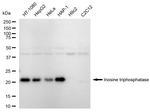 ITPA Recombinant Rabbit Monoclonal Antibody (23GB5975)