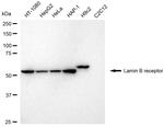 Lamin B Receptor Antibody in Western Blot (WB)