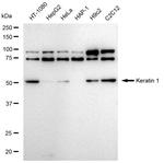Cytokeratin 1 Antibody in Western Blot (WB)