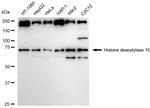 HDAC10 Antibody in Western Blot (WB)