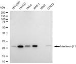 IFN beta Recombinant Rabbit Monoclonal Antibody (23GB6230)