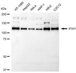 MDA5 Recombinant Rabbit Monoclonal Antibody (23GB6270)
