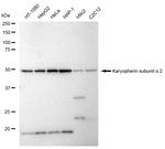 KPNA2 Recombinant Rabbit Monoclonal Antibody (23GB6295)