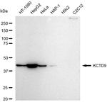 KCTD9 Antibody in Western Blot (WB)
