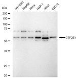 GTF2E1 Antibody in Western Blot (WB)