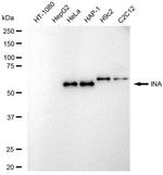 alpha Internexin Recombinant Rabbit Monoclonal Antibody (23GB6325)