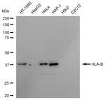 HLA-B Recombinant Rabbit Monoclonal Antibody (23GB6375)