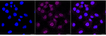 LIMK1 Antibody in Immunocytochemistry (ICC/IF)