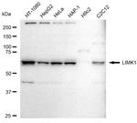 LIMK1 Recombinant Rabbit Monoclonal Antibody (23GB6425)