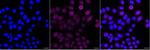GRB7 Antibody in Immunocytochemistry (ICC/IF)