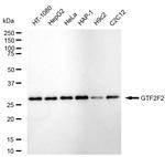 GTF2F2 Antibody in Western Blot (WB)
