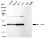MHC Class I Recombinant Rabbit Monoclonal Antibody (23GB6515)