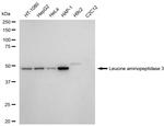 LAP3 Recombinant Rabbit Monoclonal Antibody (23GB6525)