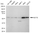 KLF10 Recombinant Rabbit Monoclonal Antibody (23GB6605)