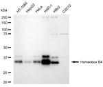 HOXB4 Antibody in Western Blot (WB)