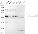 INHBB Recombinant Rabbit Monoclonal Antibody (23GB6625)