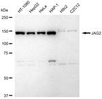 Jagged 2 Recombinant Rabbit Monoclonal Antibody (23GB6640)